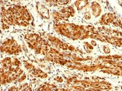 Immunohistochemistry-Paraffin: Calponin 1 Antibody (CNN1/832) [NBP2-44481]