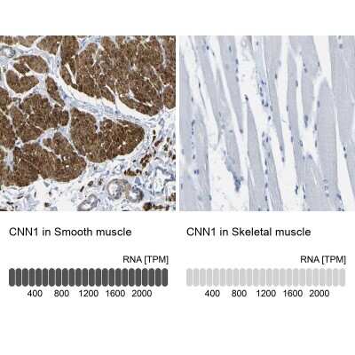 Immunohistochemistry-Paraffin: Calponin 1 Antibody [NBP1-87029]