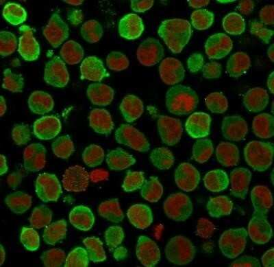 Immunocytochemistry/ Immunofluorescence: Calponin 1 Antibody (SPM169) - Azide and BSA Free [NBP2-47713]