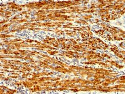 Immunohistochemistry-Paraffin: Calponin 1 Antibody (SPM169) - IHC-Prediluted [NBP2-48204]