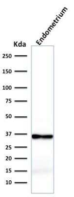 Western Blot: Calponin 1 Antibody (rCNN1/832)Azide and BSA Free [NBP2-54381]