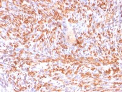 Immunohistochemistry-Paraffin: Calponin 1 Antibody (rCNN1/832) [NBP2-53222]
