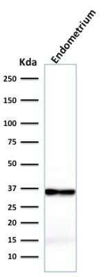 Western Blot: Calponin 1 Antibody (rCNN1/832) [NBP2-53222]