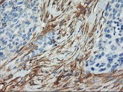 Immunohistochemistry-Paraffin: Calponin 2 Antibody (OTI2B5) [NBP2-01325]