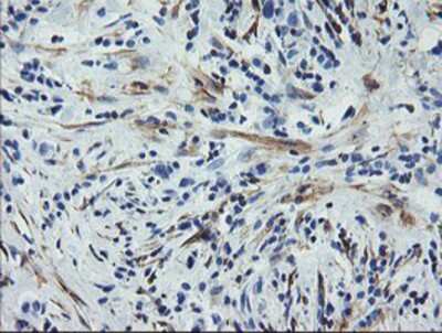 Immunohistochemistry-Paraffin: Calponin 2 Antibody (OTI2B5) [NBP2-01325]