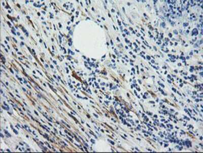 Immunohistochemistry-Paraffin: Calponin 2 Antibody (OTI2B5) [NBP2-01325]