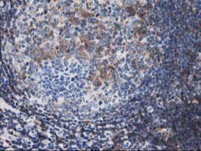 Immunohistochemistry-Paraffin: Calponin 2 Antibody (OTI2B5) [NBP2-01325]