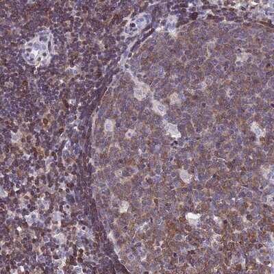 Immunohistochemistry-Paraffin: Calponin 2 Antibody [NBP2-13848]