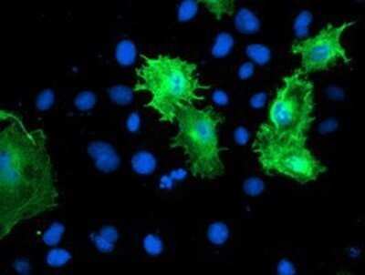 Immunocytochemistry/ Immunofluorescence: Calponin 2 Antibody (OTI2B5) - Azide and BSA Free [NBP2-70421]