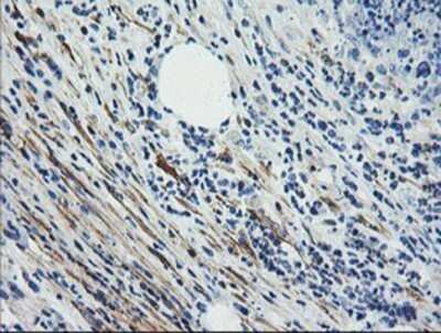 Immunohistochemistry: Calponin 2 Antibody (OTI2B5) - Azide and BSA Free [NBP2-70421]