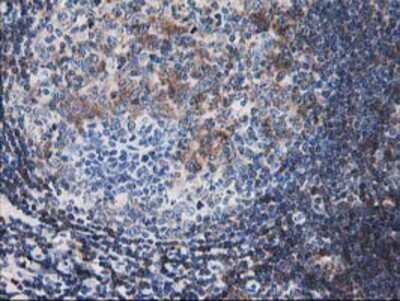Immunohistochemistry: Calponin 2 Antibody (OTI2B5) - Azide and BSA Free [NBP2-70421]