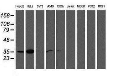 Western Blot: Calponin 2 Antibody (OTI2B5)Azide and BSA Free [NBP2-70421]