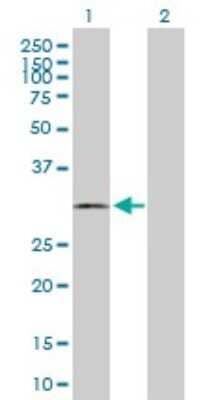 Western Blot: Calponin 2 Antibody [H00001265-B01P]