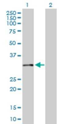 Western Blot: Calponin 2 Antibody [H00001265-D01P]