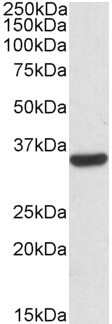 Western Blot: Calponin 2 Antibody [NBP1-36741]