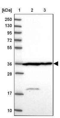 Western Blot: Calponin 2 Antibody [NBP2-13848]