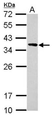 Western Blot: Calponin 2 Antibody [NBP2-15679]