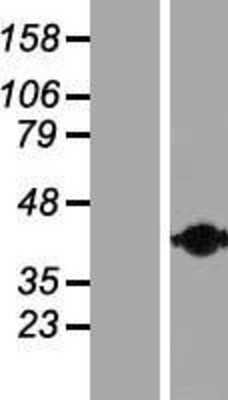 Western Blot: Calponin 2 Overexpression Lysate [NBP2-10589]