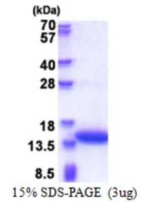 SDS-PAGE: Recombinant Human Calponin 2 His Protein [NBP2-51593]