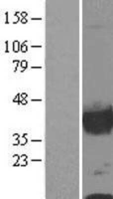 Western Blot: Calponin 1 Overexpression Lysate [NBL1-09314]