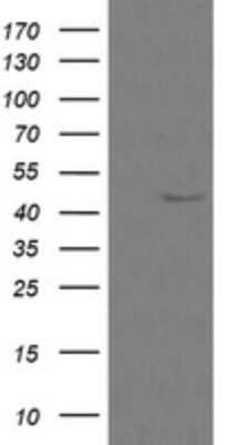 Western Blot: Calreticulin-2/CALR3 Antibody (OTI1E1) [NBP2-45586]