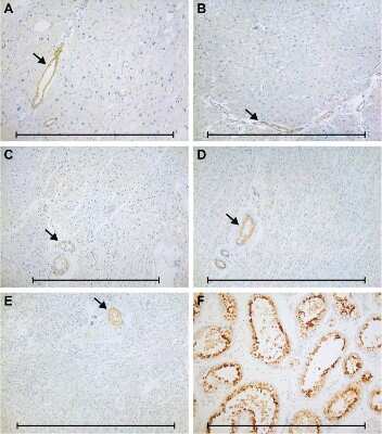 Immunohistochemistry: Calreticulin-2/CALR3 Antibody [NBP2-33390]