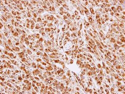 Immunohistochemistry-Paraffin: Calreticulin-2/CALR3 Antibody [NBP1-33337]