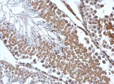 Immunohistochemistry-Paraffin: Calreticulin-2/CALR3 Antibody [NBP1-33337]