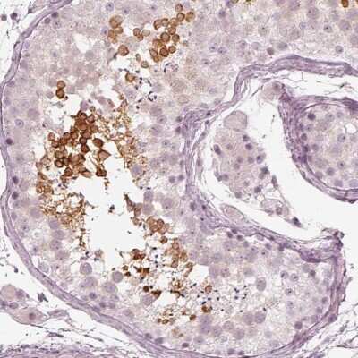 Immunohistochemistry-Paraffin: Calreticulin-2/CALR3 Antibody [NBP2-33390]