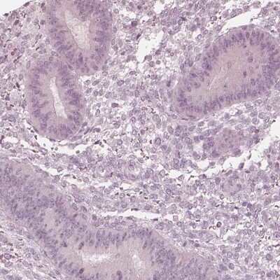 Immunohistochemistry-Paraffin: Calreticulin-2/CALR3 Antibody [NBP2-33390]