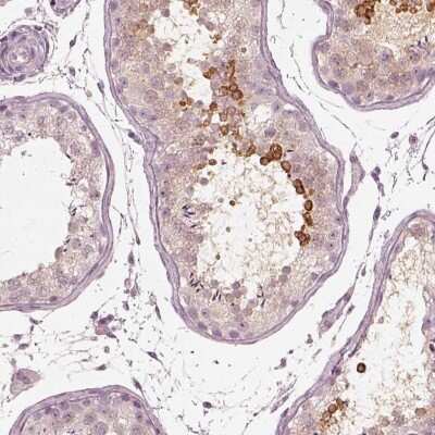 Immunohistochemistry-Paraffin: Calreticulin-2/CALR3 Antibody [NBP2-33390]