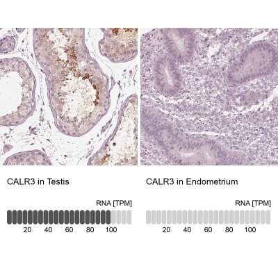 Immunohistochemistry-Paraffin: Calreticulin-2/CALR3 Antibody [NBP2-33390]