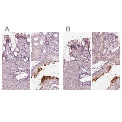 Immunohistochemistry-Paraffin: Calreticulin-2/CALR3 Antibody [NBP2-33390]