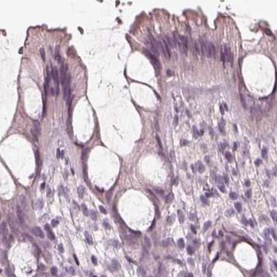 Immunohistochemistry-Paraffin: Calreticulin-2/CALR3 Antibody [NBP2-33390]