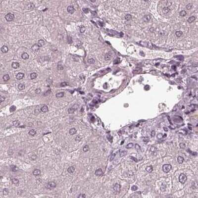 Immunohistochemistry-Paraffin: Calreticulin-2/CALR3 Antibody [NBP2-33390]