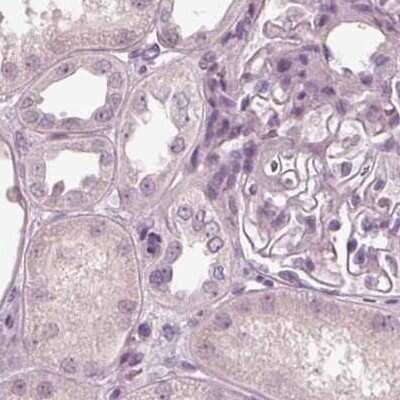 Immunohistochemistry-Paraffin: Calreticulin-2/CALR3 Antibody [NBP2-33390]