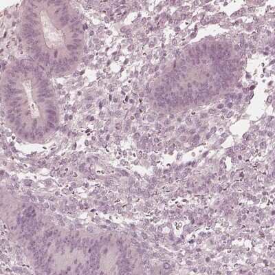 Immunohistochemistry-Paraffin: Calreticulin-2/CALR3 Antibody [NBP2-33524]