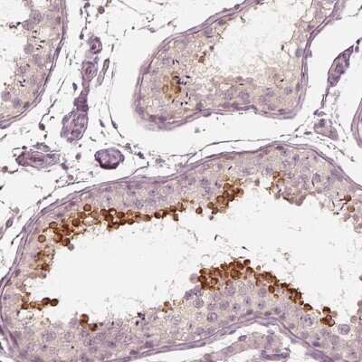 Immunohistochemistry-Paraffin: Calreticulin-2/CALR3 Antibody [NBP2-33524]