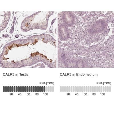 Immunohistochemistry-Paraffin: Calreticulin-2/CALR3 Antibody [NBP2-33524]