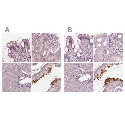 Immunohistochemistry-Paraffin: Calreticulin-2/CALR3 Antibody [NBP2-33524]