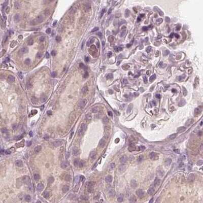 Immunohistochemistry-Paraffin: Calreticulin-2/CALR3 Antibody [NBP2-33524]