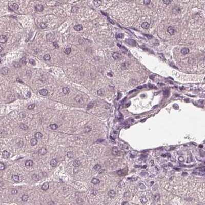 Immunohistochemistry-Paraffin: Calreticulin-2/CALR3 Antibody [NBP2-33524]