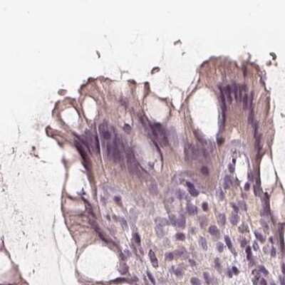 Immunohistochemistry-Paraffin: Calreticulin-2/CALR3 Antibody [NBP2-33524]