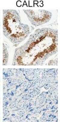 Immunohistochemistry-Paraffin: Calreticulin-2/CALR3 Antibody [NBP2-33524]