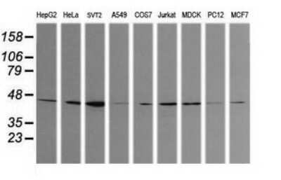 Western Blot: Calreticulin-2/CALR3 Antibody (OTI1E1)Azide and BSA Free [NBP2-72380]