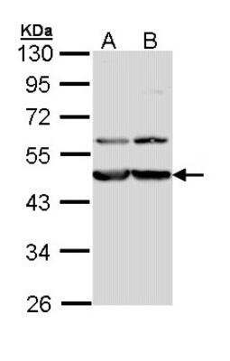 Western Blot: Calreticulin-2/CALR3 Antibody [NBP1-33337]