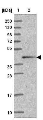 Western Blot: Calreticulin-2/CALR3 Antibody [NBP2-33524]
