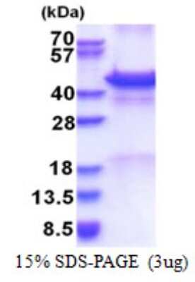 SDS-PAGE: Recombinant Human Calreticulin-2/CALR3 Protein [NBP2-51587]