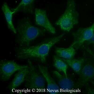 Immunocytochemistry/ Immunofluorescence: Calreticulin Antibody (1G6A7) - Azide and BSA Free [NBP2-80610]