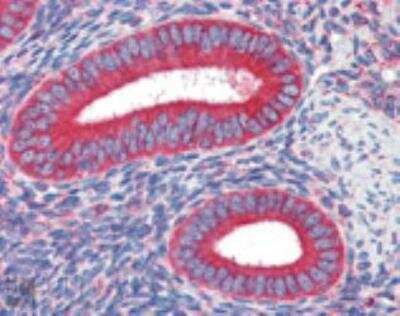 Immunohistochemistry-Paraffin: Calreticulin Antibody (FMC 75) [NBP1-97502]
